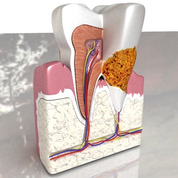 tooth dental plaque high detail 3d model 3ds max fbx obj 130059